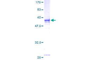 MPPED2 Protein (AA 1-294) (GST tag)