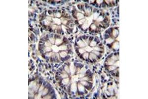 Formalin fixed, paraffin embedded human rectum tissue stained with CTBP2 Antibody (N-term) followed by peroxidase conjugation of the secondary antibody and DAB staining. (CTBP2 抗体  (N-Term))