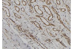 ABIN6276872 at 1/100 staining Human kidney tissue by IHC-P. (BUB1B 抗体  (C-Term))