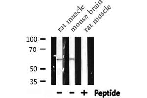 Western blot analysis of NCF2 expression in various lysates
