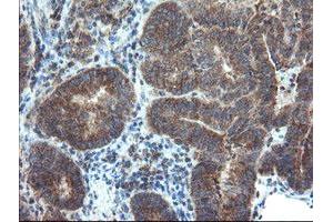 Image no. 1 for anti-Dual Specificity Phosphatase and Pro Isomerase Domain Containing 1 (DUPD1) antibody (ABIN1497927) (DUPD1 抗体)