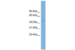 C10orf30 antibody used at 1 ug/ml to detect target protein. (BEND7 抗体  (N-Term))
