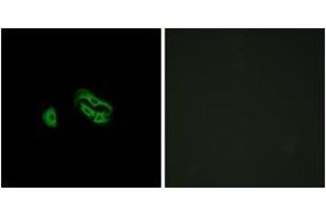 Immunofluorescence analysis of HeLa cells, using FPRL2 Antibody. (FPR3 抗体  (AA 304-353))