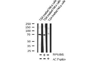 Western blot analysis on TSA treated HeLa cells lysate using AC-FKHR(K294) Antibody (AC-FKHR 抗体)