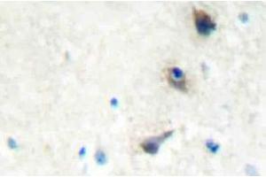 Immunohistochemistry (IHC) analyzes of IMK-1 antibody in paraffin-embedded human brain tissue. (LIM Domain Kinase 1 抗体)