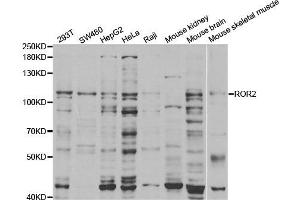 Western Blotting (WB) image for anti-Receptor Tyrosine Kinase-Like Orphan Receptor 2 (ROR2) antibody (ABIN1876821) (ROR2 抗体)