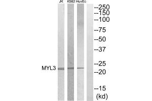 Western blot analysis of extracts from HuvEC, K562 and Jurkat cells, using MYL3 antibody. (MYL3/CMLC1 抗体  (Internal Region))