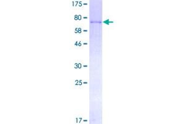 Coagulation Factor IX Protein (F9) (AA 1-461) (GST tag)