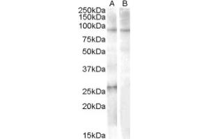 Image no. 1 for anti-Apolipoprotein B mRNA Editing Enzyme, Catalytic Polypeptide-Like 2 (APOBEC2) (Internal Region), (N-Term) antibody (ABIN374923) (APOBEC2 抗体  (Internal Region, N-Term))