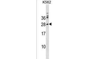 PTCRA Antibody (C-term) (ABIN1536828 and ABIN2850366) western blot analysis in K562 cell line lysates (35 μg/lane). (PTCRA 抗体  (C-Term))