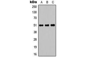 Western blot analysis of POTEA expression in HEK293T (A), Raw264. (POTEA 抗体  (C-Term))