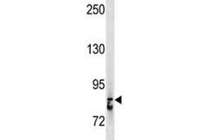 Western Blotting (WB) image for anti-Signal Transducer and Activator of Transcription 3 (Acute-Phase Response Factor) (STAT3) (AA 673-699) antibody (ABIN3032571)