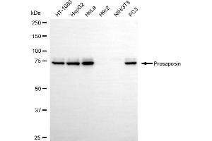 Western blotting analysis using prosaposin antibody (ABIN7799930). (Recombinant Prosaposin 抗体)