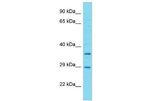 Host: Rabbit Target Name: FAHD1 Sample Type: Hela Whole cell lysates Antibody Dilution: 1. (FAHD1 抗体  (Middle Region))