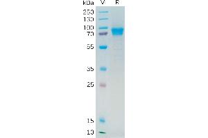 SDS-PAGE (SDS) image for Interleukin 21 Receptor (IL21R) (AA 20-232) protein (Fc Tag) (ABIN7092688)