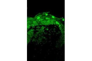 Immunofluorescence (IF) image for anti-Calcium Channel, Voltage-Dependent, L Type, alpha 1D Subunit (CACNA1D) (Internal Region) antibody (ABIN6658113)