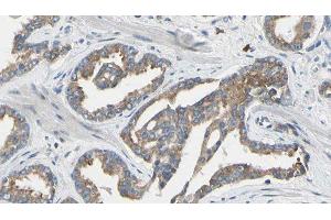 ABIN6277640 at 1/100 staining Human prostate tissue by IHC-P. (Asparagine Synthetase 抗体  (N-Term))
