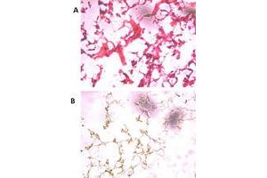 HE staining of frozen human ovarian cancer tissue reacted with the primary antibody at a 1:250 dilution.