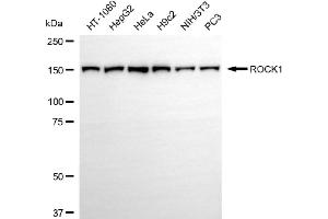 anti-rho-Associated, Coiled-Coil Containing Protein Kinase 1 (ROCK1) antibody