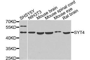 Western blot analysis of extracts of various cells, using SYT4 antibody. (SYT4 抗体)