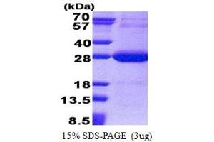 SDS-PAGE (SDS) image for NADH Dehydrogenase (Ubiquinone) Flavoprotein 2, 24kDa (NDUFV2) (AA 33-249) protein (His tag) (ABIN5853221) (NDUFV2 Protein (AA 33-249) (His tag))