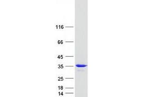 Western Blotting (WB) image for RAB20, Member RAS Oncogene Family (RAB20) protein (Myc-DYKDDDDK Tag) (ABIN2730285)