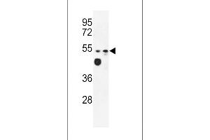 Western blot analysis of LD2 Antibody (C-term) (ABIN653167 and ABIN2842732) in WiDr, MDA-M cell line lysates (35 μg/lane). (Tricellulin 抗体  (C-Term))