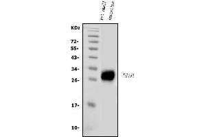 Western blot analysis of Tspan1 using anti-Tspan1 antibody (ABIN7599878).