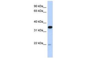 Image no. 1 for anti-Phosphotidylinositol Transfer Protein, beta (PITPNB) (AA 107-156) antibody (ABIN6743263) (PITPNB 抗体  (AA 107-156))