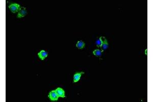 Immunofluorescent analysis of Hela cells using ABIN7160057 at dilution of 1:100 and Alexa Fluor 488-congugated AffiniPure Goat Anti-Rabbit IgG(H+L) (MAP3K8 抗体  (AA 1-300))