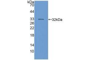 Detection of Recombinant C6, Human using Polyclonal Antibody to Complement Component 6 (C6) (C6 抗体  (AA 682-934))
