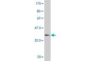 Western Blot detection against Immunogen (37. (PRPS2 抗体  (AA 160-269))