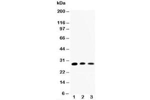 Western blot testing of AQP1 antibody and Lane 1:  rat kidney;  2: rat lung;  3: SMMC-7721 cell lysate (Aquaporin 1 抗体  (C-Term))