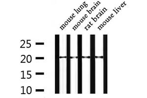Western blot analysis of extracts from mouse lung, mouse brain, rat brain, mouse liver, using NTS Antibody. (Neurotensin 抗体  (C-Term))