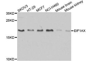 Western blot analysis of extracts of various cell lines, using EIF1AX antibody. (EIF1AX 抗体  (AA 10-144))