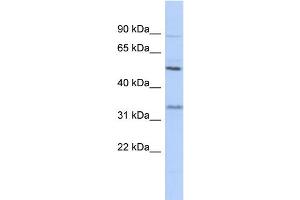 WB Suggested Anti-PRSS35 Antibody Titration: 0. (PRSS35 抗体  (N-Term))