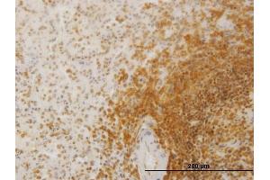 Immunoperoxidase of monoclonal antibody to SLC26A3 on formalin-fixed paraffin-embedded human spleen. (SLC26A3 抗体  (AA 503-600))