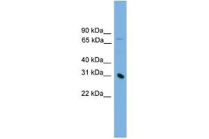 Human Jurkat; WB Suggested Anti-PRSS8 Antibody Titration: 0. (PRSS8 抗体  (Middle Region))