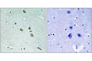 Immunohistochemistry analysis of paraffin-embedded human brain tissue, using ILK (Ab-246) Antibody. (ILK 抗体  (AA 212-261))