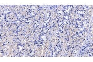 Immunohistochemistry (IHC) image for anti-Lipolysis Stimulated Lipoprotein Receptor (LSR) (AA 335-589) antibody (ABIN7435571)