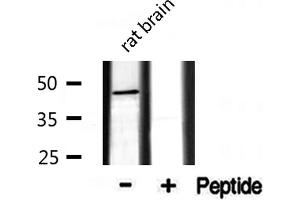 Western blot analysis of extracts from rat Brian, using CADM2 antibody. (CADM2 抗体  (Internal Region))