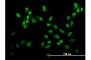 Immunofluorescence of monoclonal antibody to USF2 on HeLa cell. (USF2 抗体  (AA 1-100))