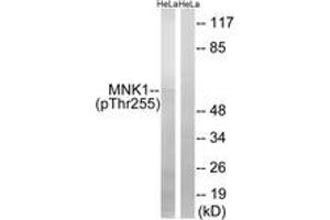 Western blot analysis of extracts from HeLa cells treated with Adriamycin 0. (MKNK1 抗体  (pThr255))