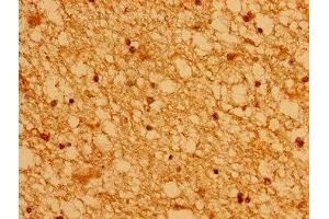 Immunohistochemistry of paraffin-embedded human brain tissue using ABIN7142982 at dilution of 1:100 (ASCL1 抗体  (AA 1-236))
