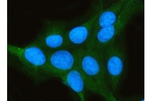 IF analysis of PPP2CA using anti-PPP2CA antibody (ABIN3043356).