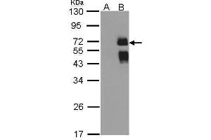 WB Image Western Blot analysis of ST6GAL1 expression in transfected 293T cell line by ST6GAL1 polyclonal antibody. (ST6GAL1 抗体  (Center))