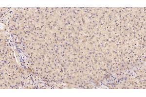 Detection of MANF in Human Liver Tissue using Monoclonal Antibody to Mesencephalic Astrocyte Derived Neurotrophic Factor (MANF) (MANF 抗体  (AA 28-182))