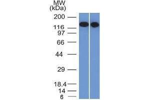 Western Blot Analysis of Raji and Ramos cell lysates using CD22-Monospecific Mouse Monoclonal Antibody (BLCAM/1795).