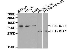 Western blot analysis of extracts of various cell lines, using HLA-DQA1 antibody. (HLA-DQA1 抗体  (AA 24-216))