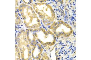 Immunohistochemistry (IHC) image for anti-Dihydropyrimidine Dehydrogenase (DPYD) (AA 1-173) antibody (ABIN3022259) (DPYD 抗体  (AA 1-173))
